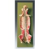 Spinal Cord in Spinal Canal Model