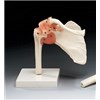 Shoulder Joint with Ligaments